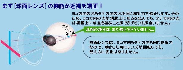 球面レンズが近視を矯正