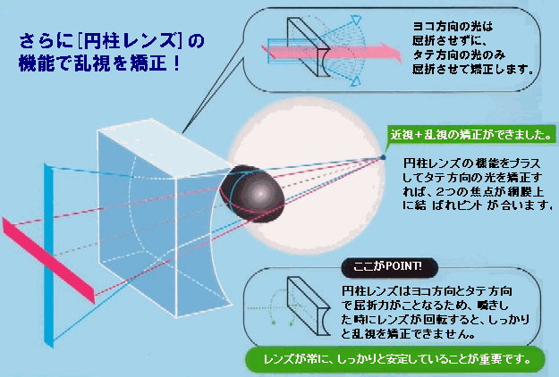 円柱レンズが乱視を矯正